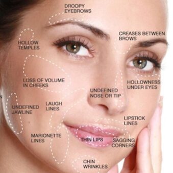 Dermal Fillers in Haldwani-maxfaceclinic.in