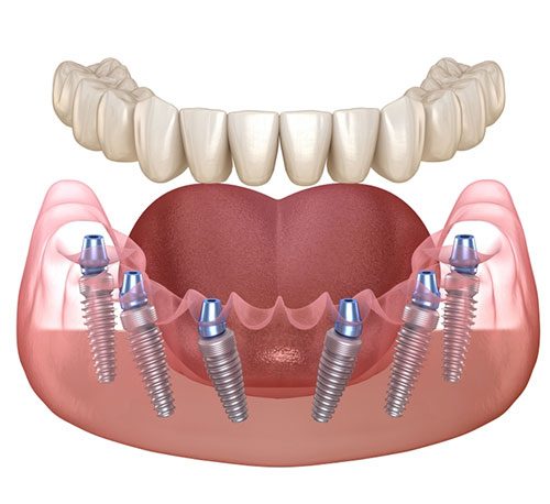 Dental Treatments - Maxface Clinic