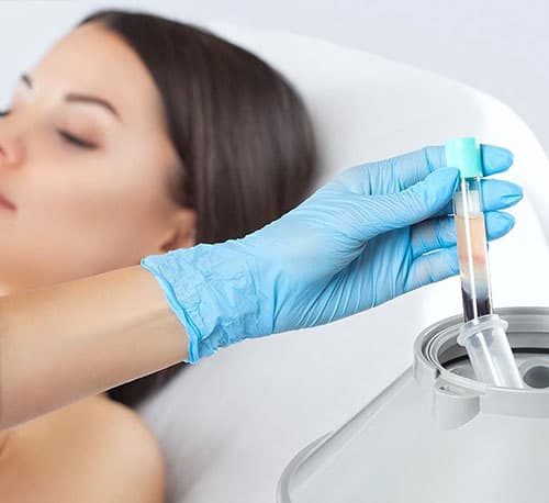 PRP-Therapy-maxfaceclinic.in